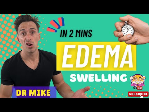 Edema (Oedema) | In 2 minutes!