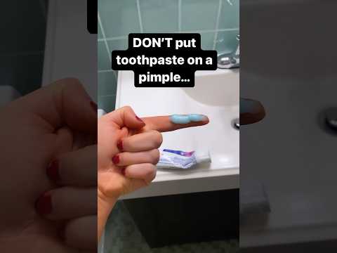 Don't put toothpaste on your pimples!