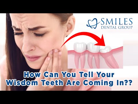 Wisdom Teeth: Important Facts (2021) - How Can You Tell They Are Coming In? What Age To Expect Them?