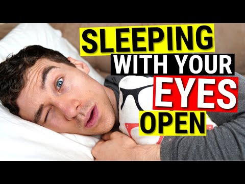 Sleeping with Eyes Open - Dry Eye Treatments for Lagophthalmos